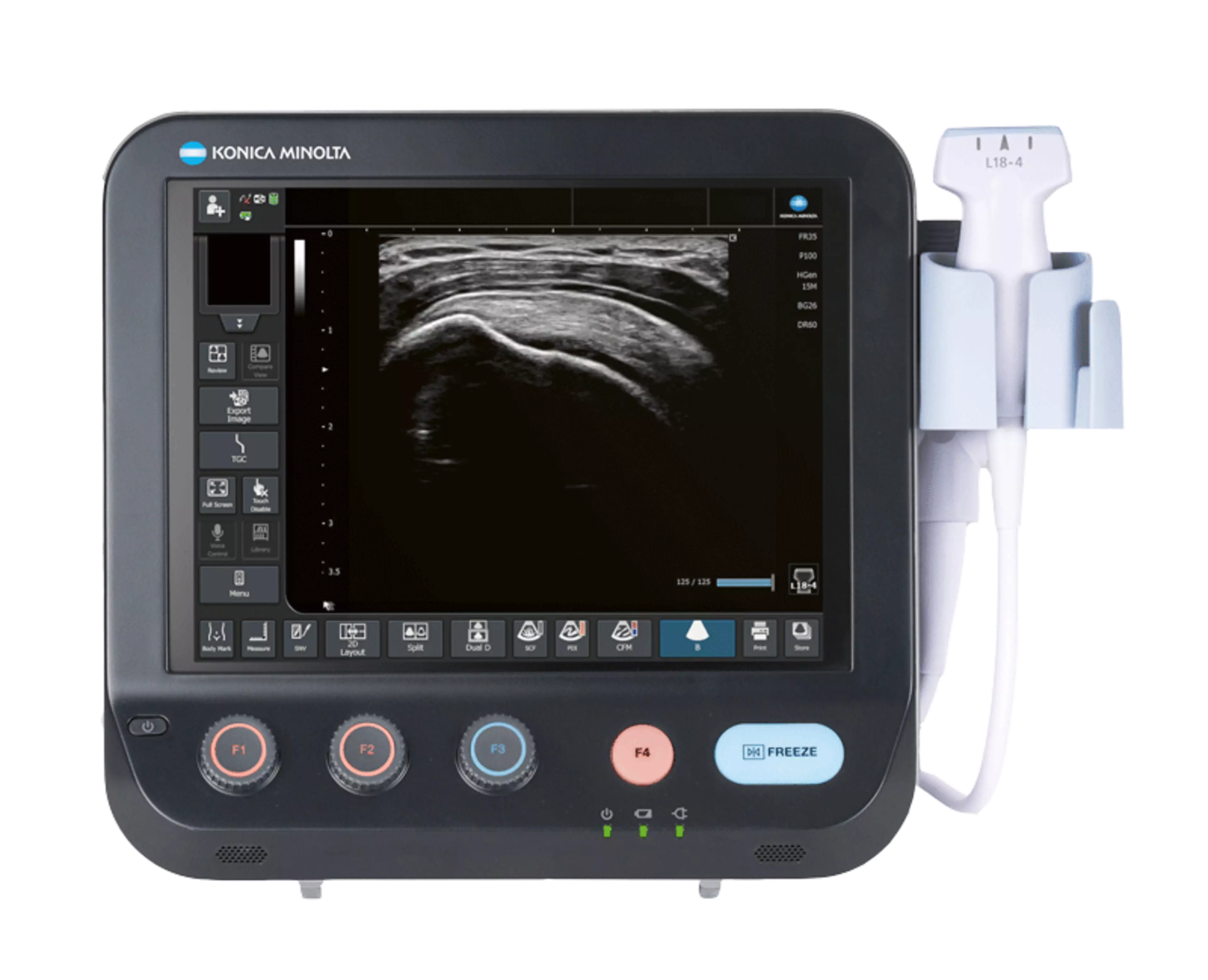 SONIMAGE® MX1 PlatinumHeroSlider
