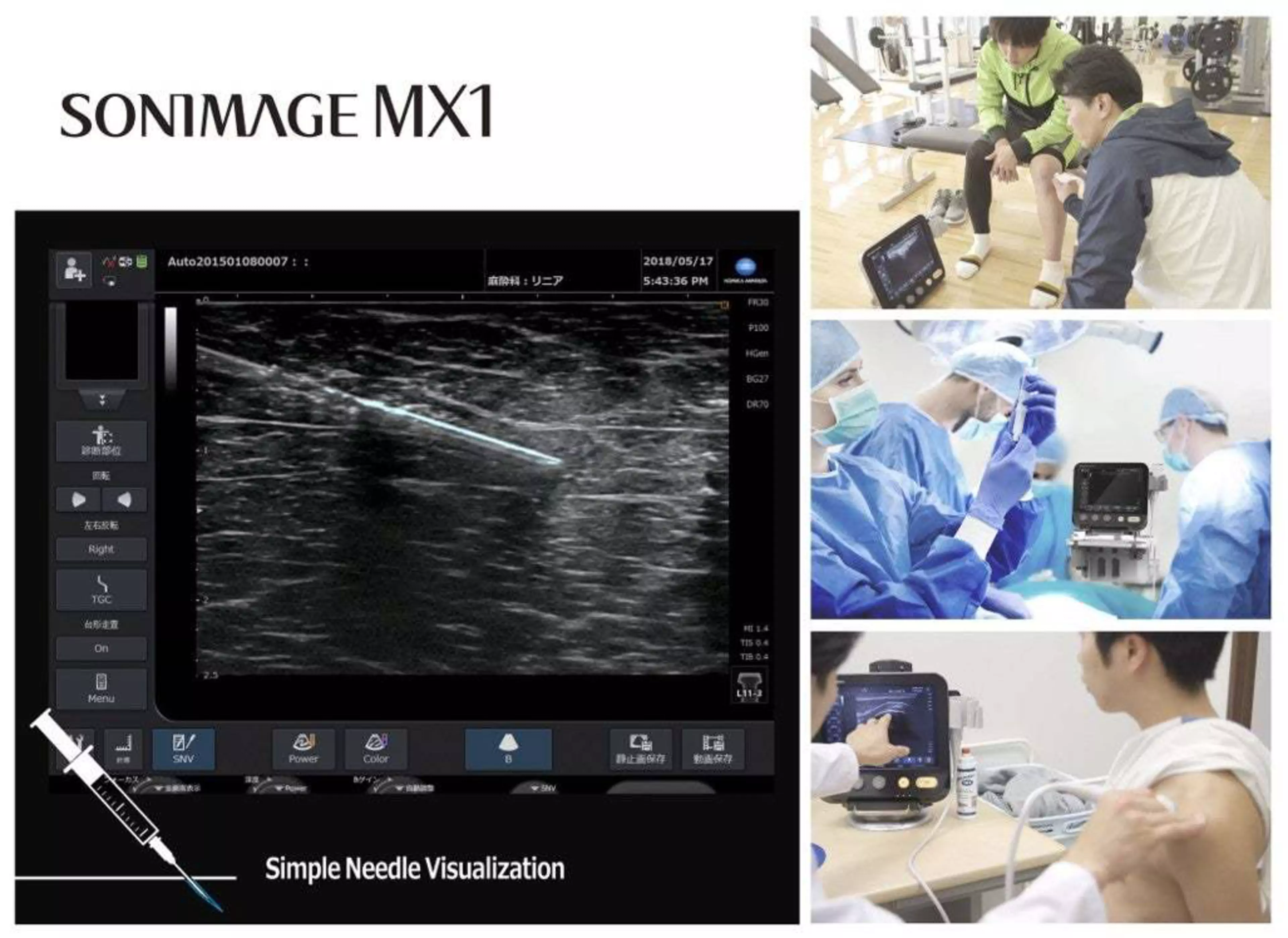 Sonimage MX1 Functionalities