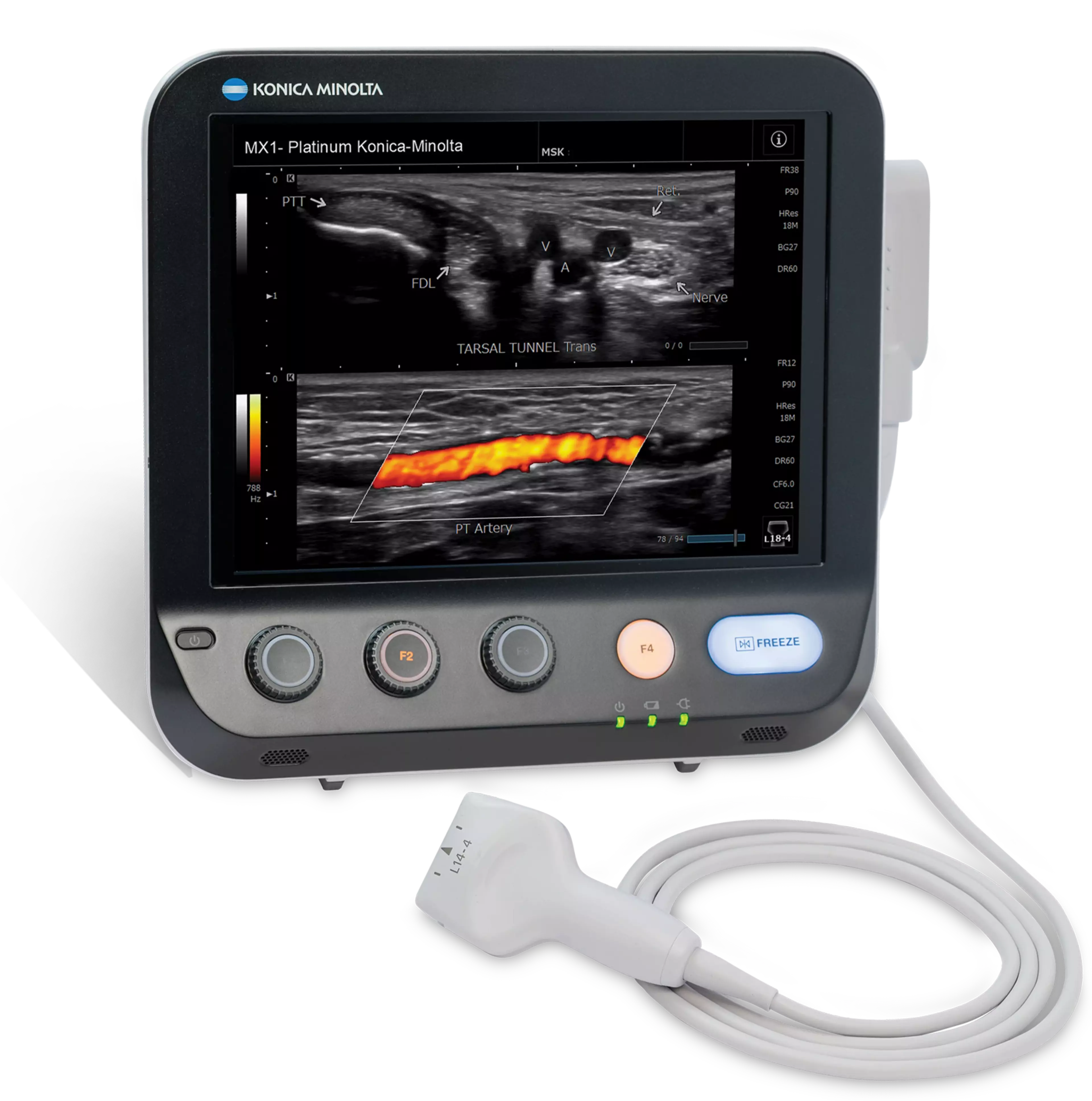 UltrasoundHeroSlider