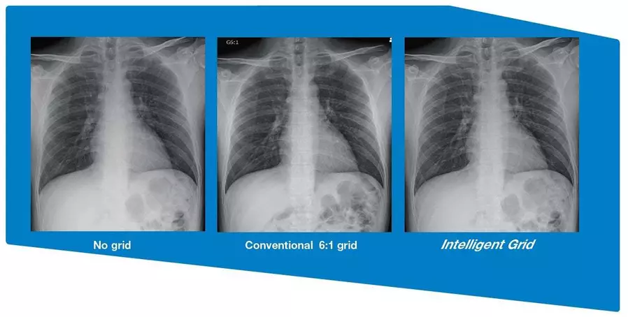 AeroDR Premium_image_3