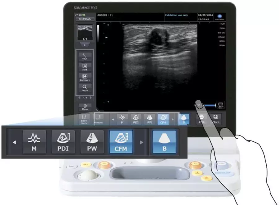 hc_Sonimage HS1 Screen