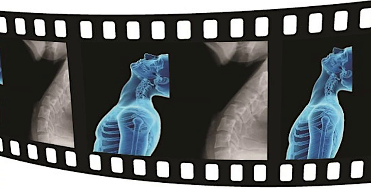 Dynamic Digital Radiography | KONICA MINOLTA