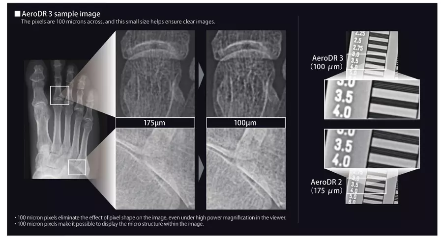 AeroDR HD_Performance Pixels